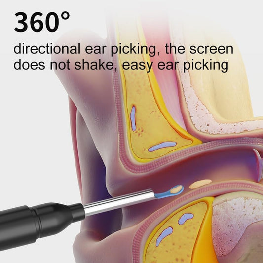 New Ear Cleaner Tool Endoscope Otoscope, Ear Wax Cleaner with 1080p FHD Camera Ear wax remover Tool with Wifi Connection & 6 LED Lights Multi (C)