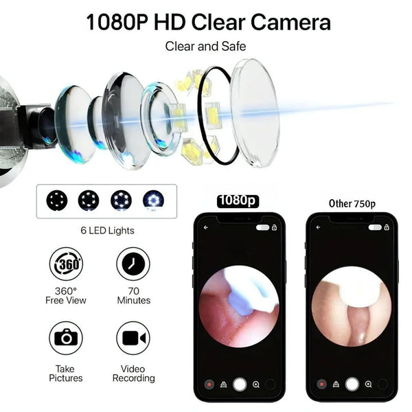 New Ear Cleaner Tool Endoscope Otoscope, Ear Wax Cleaner with 1080p FHD Camera Ear wax remover Tool with Wifi Connection & 6 LED Lights Multi (C)