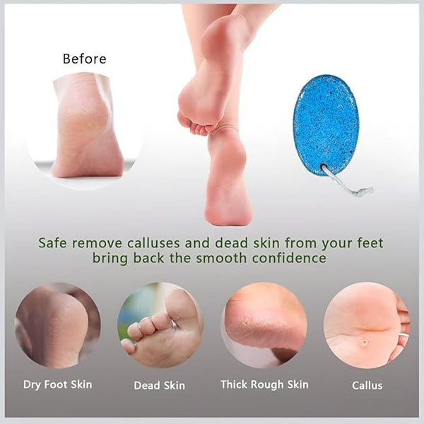 Natural Pumice Stone Pack of 2 colours Pedicure Tools Natural Foot File Exfoliation to Remove Dead Skin from Heels, Elbows, Hands and feet