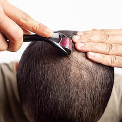 Derma Roller For Hair And Beard Regrowth 540 Micro 0.5MM Titanium Alloy Needles Reduces Hair Fall & Stimulates Hair Follicles, Safe and Effective Easy to use | Skin Care Men and Women